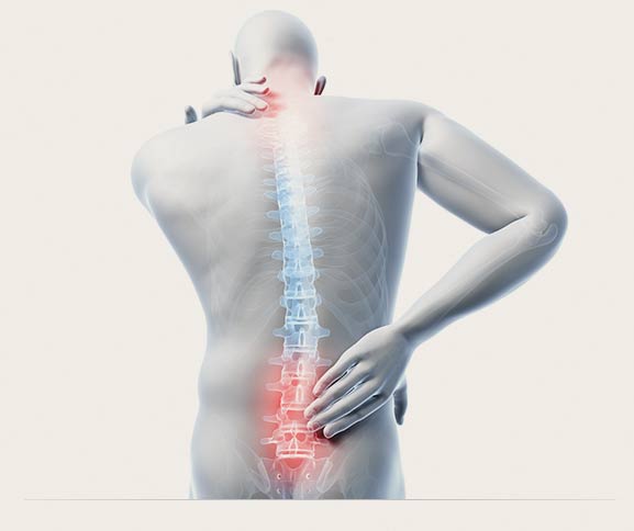 Rückenschmerzen wegen der Matratze